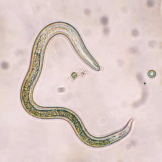 Parasitic nematode under a microscope